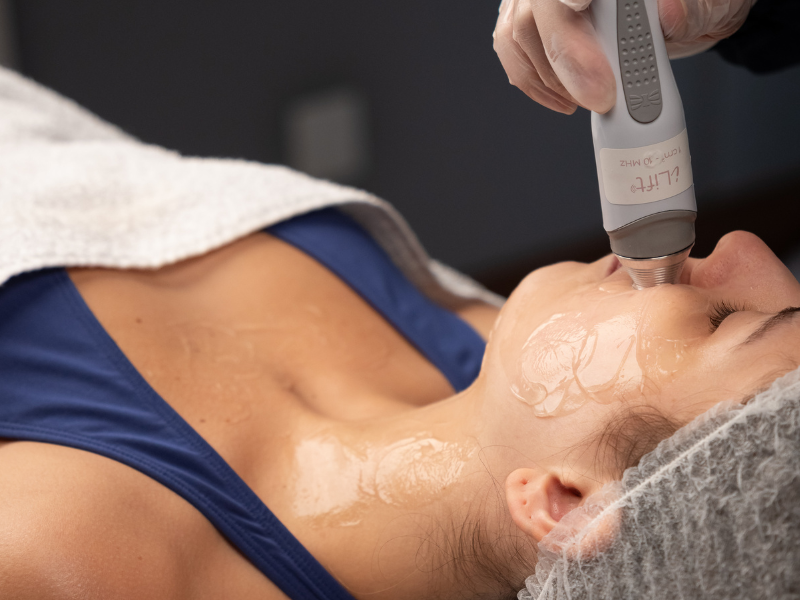 Ultrassom terapêutico avança no rejuvenescimento facial